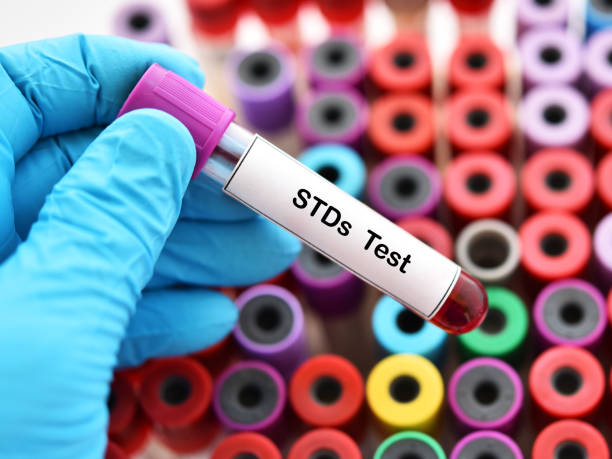 STD PCR test